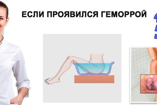Ссылка на кракен даркнет